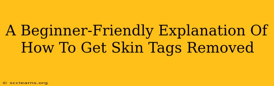 A Beginner-Friendly Explanation Of How To Get Skin Tags Removed