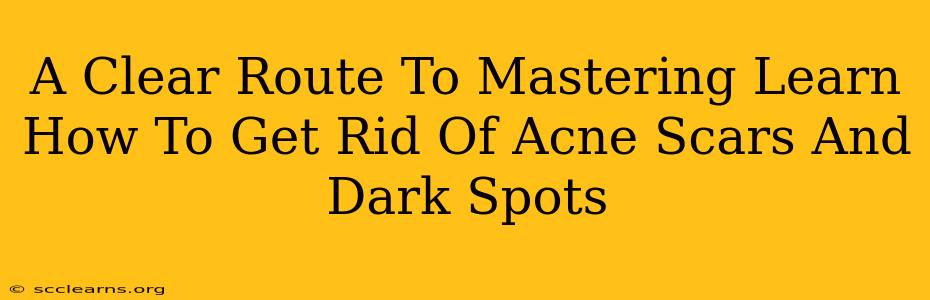 A Clear Route To Mastering Learn How To Get Rid Of Acne Scars And Dark Spots