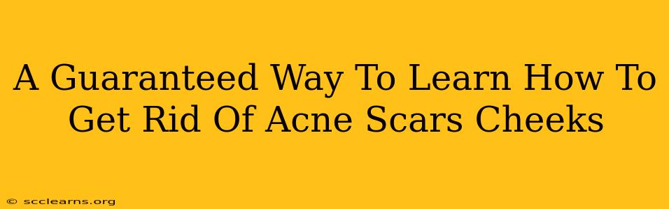 A Guaranteed Way To Learn How To Get Rid Of Acne Scars Cheeks