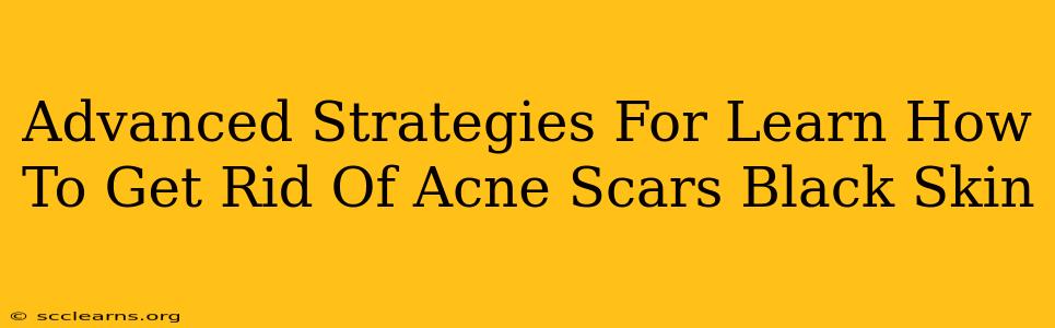 Advanced Strategies For Learn How To Get Rid Of Acne Scars Black Skin