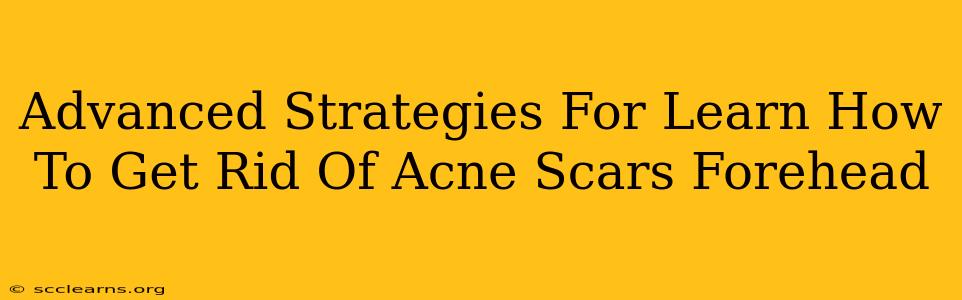 Advanced Strategies For Learn How To Get Rid Of Acne Scars Forehead