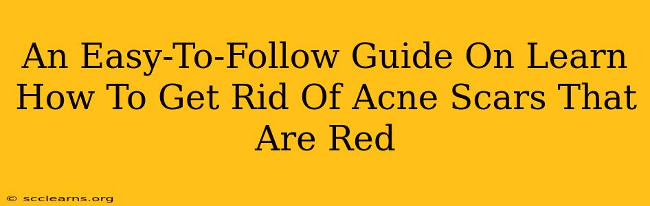 An Easy-To-Follow Guide On Learn How To Get Rid Of Acne Scars That Are Red