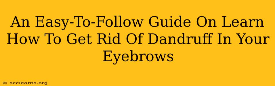 An Easy-To-Follow Guide On Learn How To Get Rid Of Dandruff In Your Eyebrows