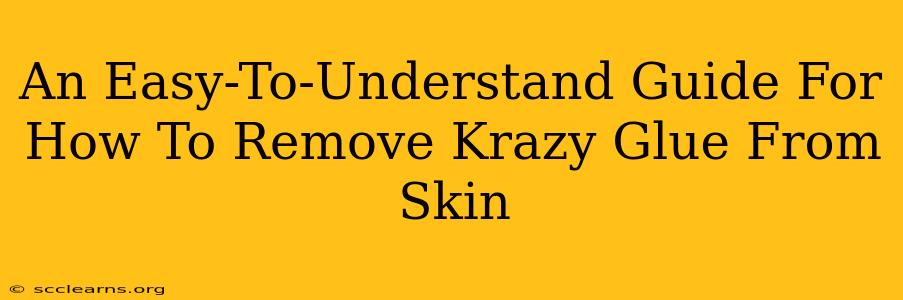 An Easy-To-Understand Guide For How To Remove Krazy Glue From Skin