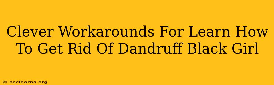 Clever Workarounds For Learn How To Get Rid Of Dandruff Black Girl