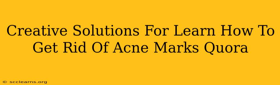 Creative Solutions For Learn How To Get Rid Of Acne Marks Quora