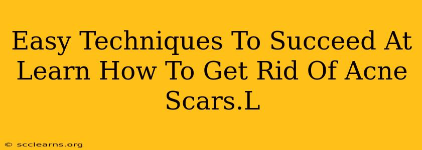 Easy Techniques To Succeed At Learn How To Get Rid Of Acne Scars.L