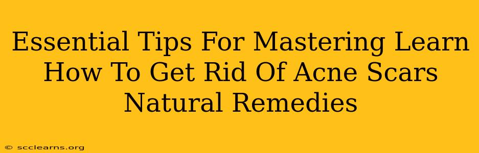 Essential Tips For Mastering Learn How To Get Rid Of Acne Scars Natural Remedies