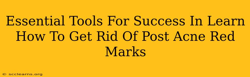 Essential Tools For Success In Learn How To Get Rid Of Post Acne Red Marks