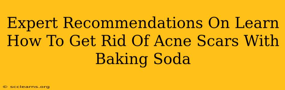 Expert Recommendations On Learn How To Get Rid Of Acne Scars With Baking Soda