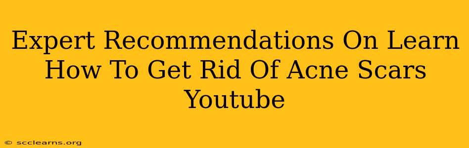 Expert Recommendations On Learn How To Get Rid Of Acne Scars Youtube