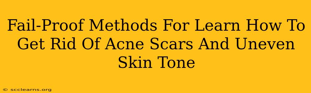 Fail-Proof Methods For Learn How To Get Rid Of Acne Scars And Uneven Skin Tone