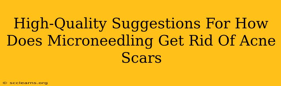 High-Quality Suggestions For How Does Microneedling Get Rid Of Acne Scars