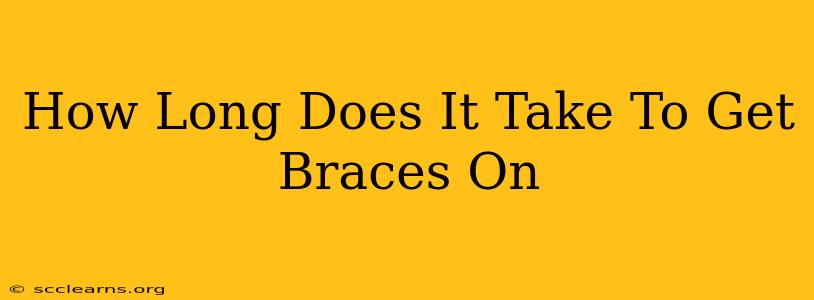 How Long Does It Take To Get Braces On