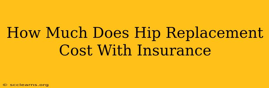 How Much Does Hip Replacement Cost With Insurance