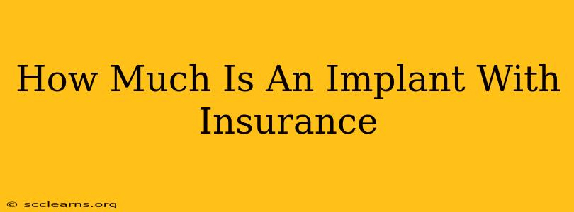 How Much Is An Implant With Insurance