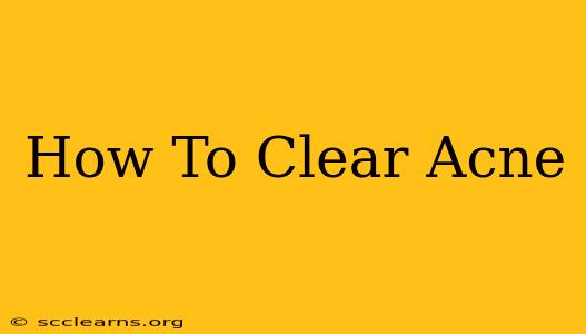 How To Clear Acne