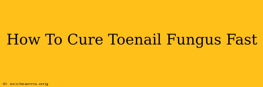 How To Cure Toenail Fungus Fast