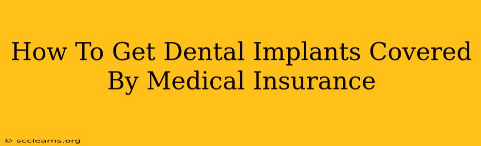 How To Get Dental Implants Covered By Medical Insurance