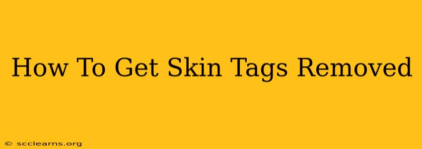 How To Get Skin Tags Removed