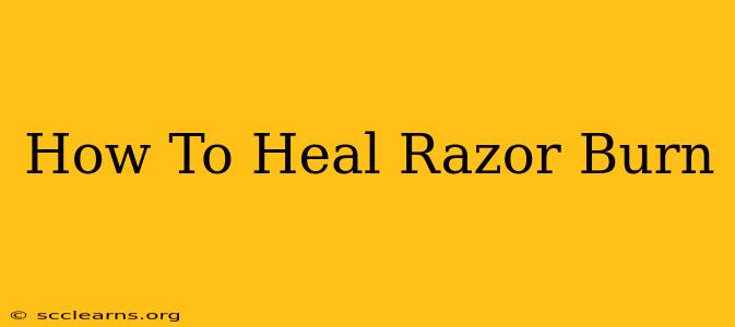 How To Heal Razor Burn