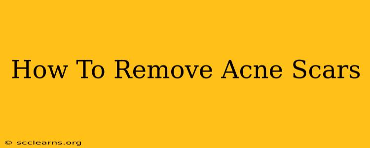 How To Remove Acne Scars