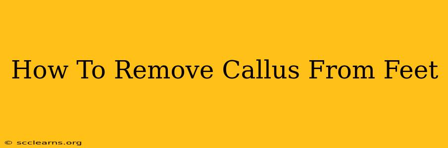 How To Remove Callus From Feet