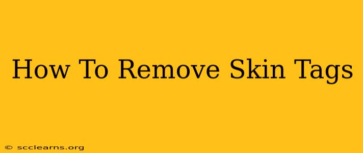 How To Remove Skin Tags