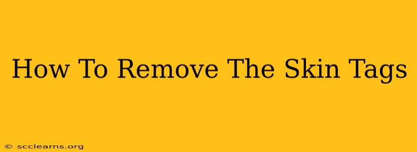 How To Remove The Skin Tags