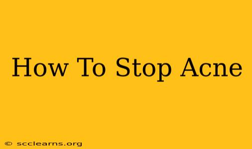 How To Stop Acne