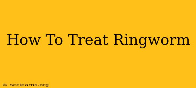 How To Treat Ringworm