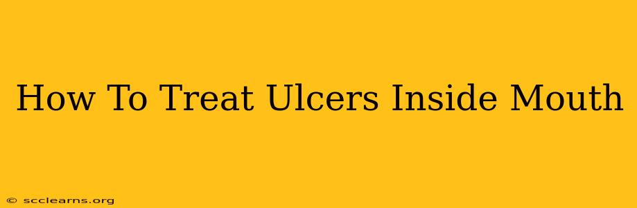 How To Treat Ulcers Inside Mouth