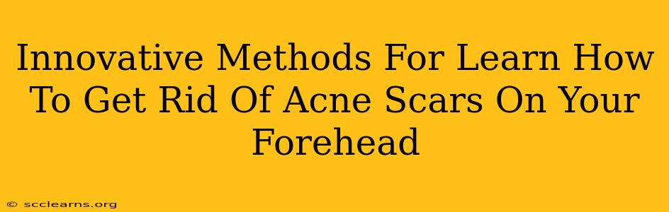 Innovative Methods For Learn How To Get Rid Of Acne Scars On Your Forehead