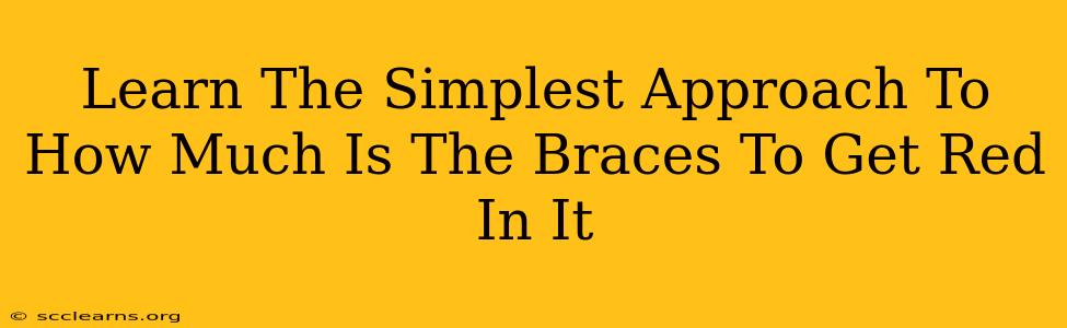 Learn The Simplest Approach To How Much Is The Braces To Get Red In It