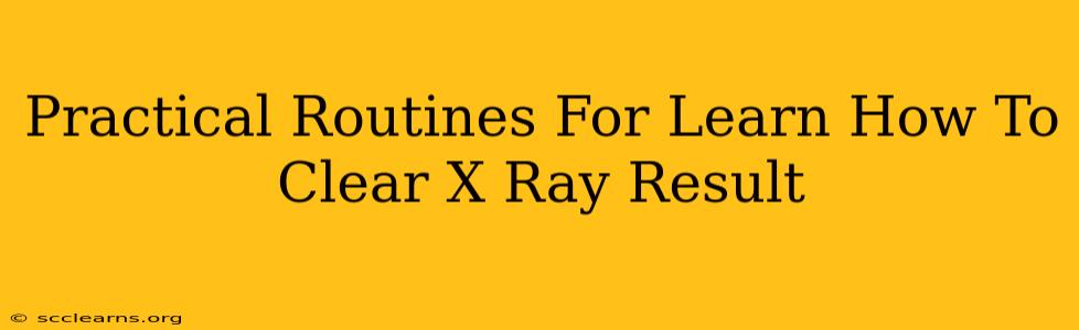 Practical Routines For Learn How To Clear X Ray Result