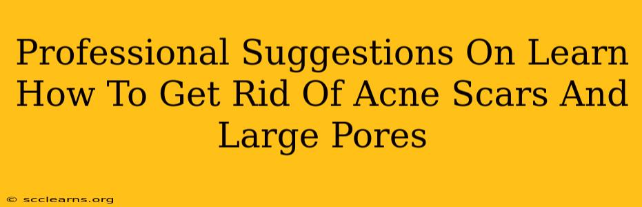 Professional Suggestions On Learn How To Get Rid Of Acne Scars And Large Pores