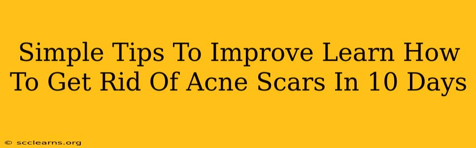 Simple Tips To Improve Learn How To Get Rid Of Acne Scars In 10 Days