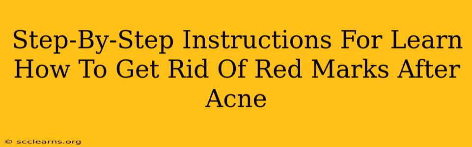 Step-By-Step Instructions For Learn How To Get Rid Of Red Marks After Acne