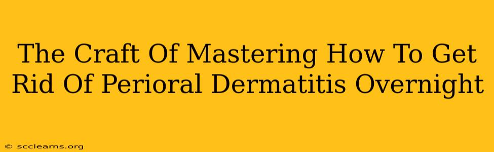 The Craft Of Mastering How To Get Rid Of Perioral Dermatitis Overnight