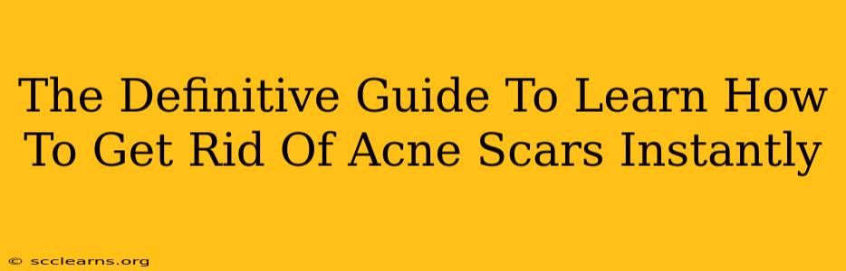 The Definitive Guide To Learn How To Get Rid Of Acne Scars Instantly