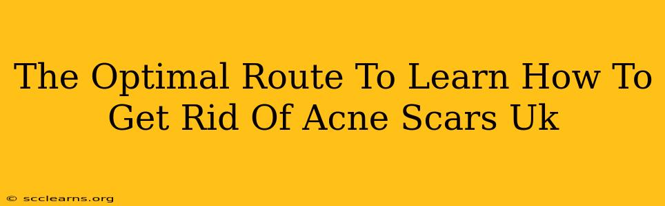 The Optimal Route To Learn How To Get Rid Of Acne Scars Uk