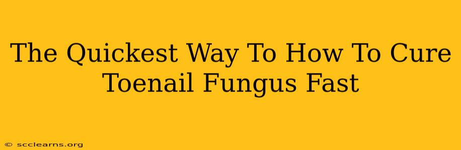 The Quickest Way To How To Cure Toenail Fungus Fast