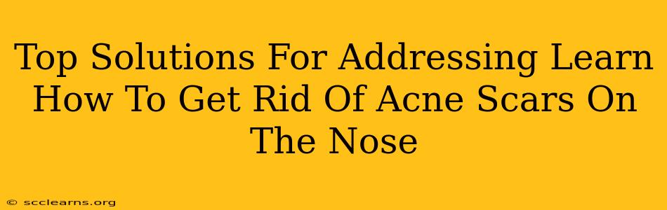 Top Solutions For Addressing Learn How To Get Rid Of Acne Scars On The Nose