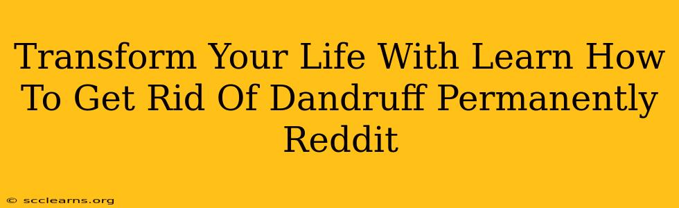 Transform Your Life With Learn How To Get Rid Of Dandruff Permanently Reddit