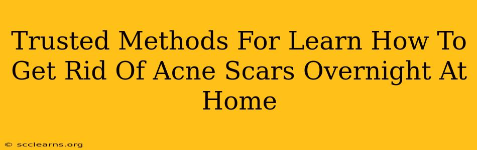 Trusted Methods For Learn How To Get Rid Of Acne Scars Overnight At Home