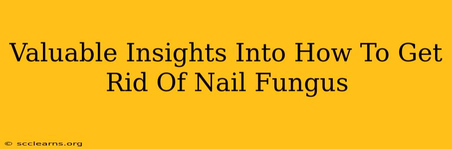 Valuable Insights Into How To Get Rid Of Nail Fungus