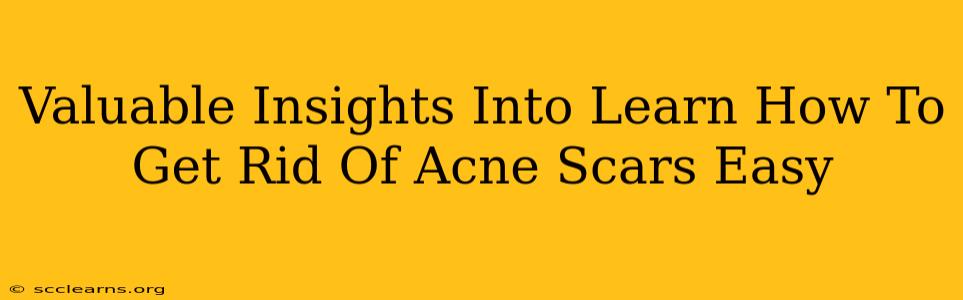 Valuable Insights Into Learn How To Get Rid Of Acne Scars Easy